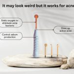 High Frequency Wand for Acne Results: How Long Until You See Changes?